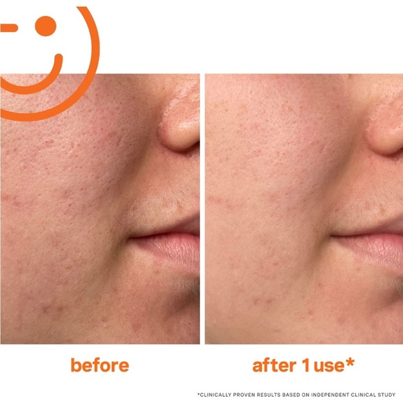 KATE SOMERVILLE • EXFOLIKATE INTENSIVE EXFOLIATING TREATMENT • BRAND NEW IN BOX - Picture 2 of 10